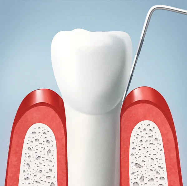 Зуб и жвачка — стоковое фото