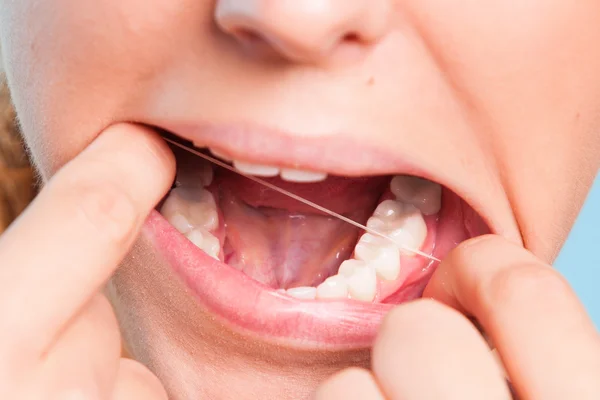 Girl showing teeth — Stock Photo, Image