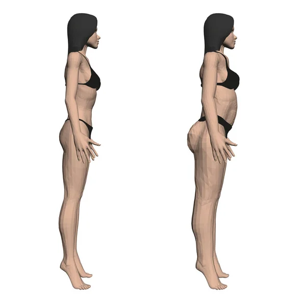 Δύο μοντέλα κορίτσια με εσώρουχα, ένα λεπτό και χοντρό κορίτσι. Η διαδικασία της παχυσαρκίας του γυναικείου σώματος. Πλευρική άποψη. 3D. Εικονογράφηση διανύσματος — Διανυσματικό Αρχείο