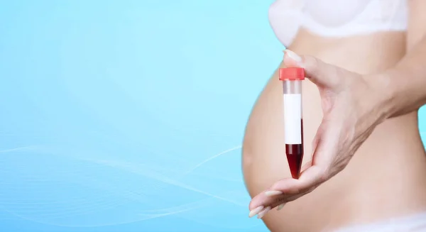 一名身穿内裤的白人孕妇拿着一个收集血液的塑料容器 一个带红色帽子的罐子 一个蓝色背景的血液测试 复制空间 高质量的照片 — 图库照片