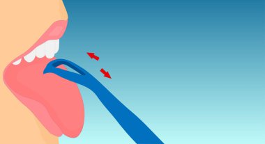 Dil kazıyıcı, kişiselleştirilmiş ağız hijyeni aleti. Evin ağzını temizle. Dişleri ve dili olan açık bir kadın ağzı ve bir kazıyıcı, dil fırçası, mavi eğimli arka planda. Uzayı kopyala Vektör illüstrasyonu