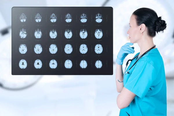 Röntgenläkaren Tittar Magnetröntgen Ultraljudet Barnets Hjärna Datortomograferingsrummet Mjuk Suddig Bakgrund — Stockfoto