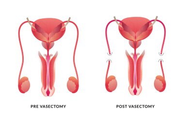 Erkek kısırlaştırması. Erkek Üreme Sistemi Anatomisi.