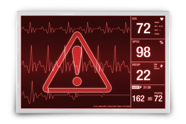 心拍数アラーム — ストック写真