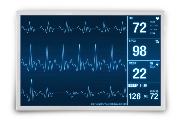 Dispositivo de monitoreo de frecuencia cardíaca — Foto de Stock