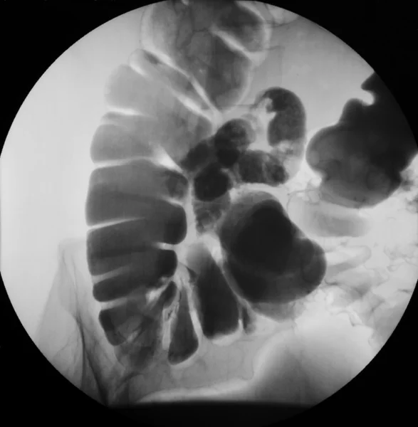 Radiographie abdominale — Photo