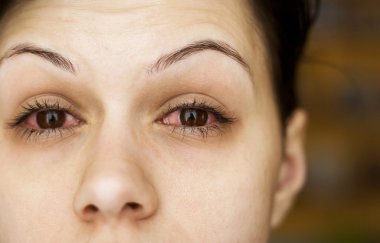 Sick woman's eyes clipart