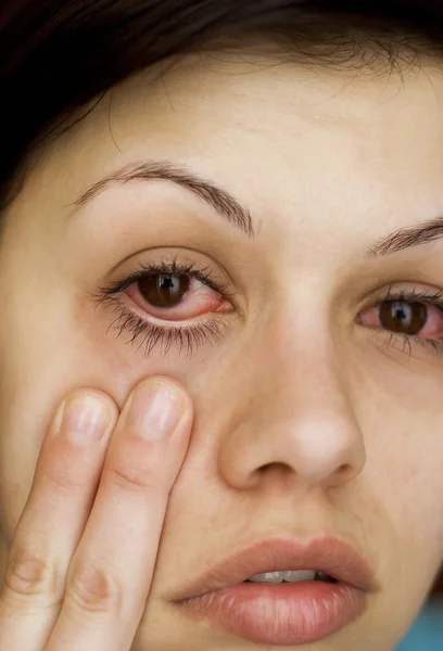 Nemocné ženy oči — Stock fotografie