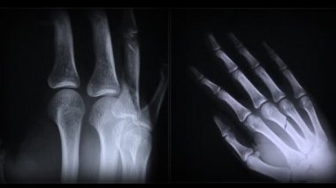 x-ışını insan vücut parçaları