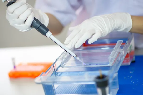 Chargement des échantillons dans le gel pour l'électrophorèse — Photo