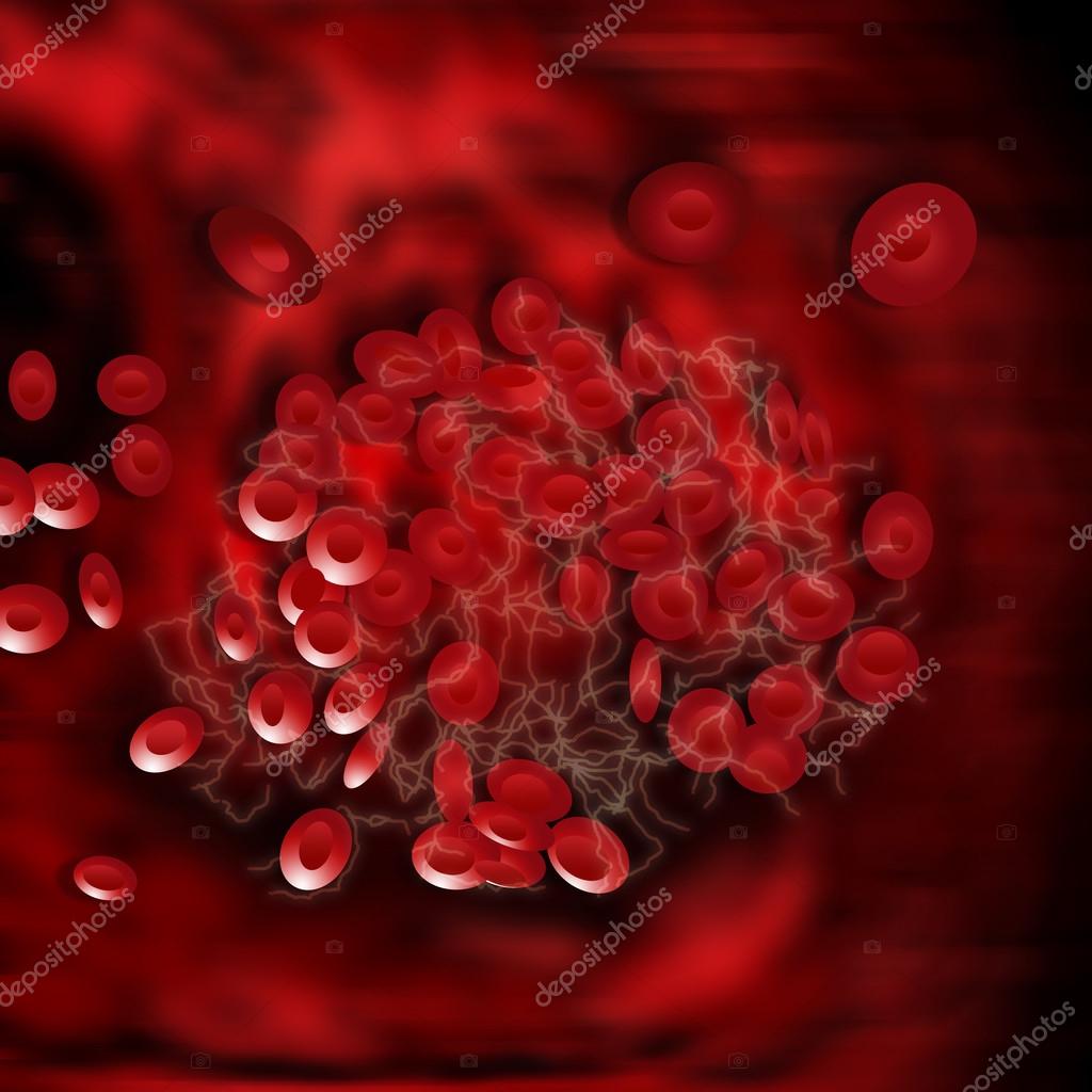 Caillot De Sang Images Libres De Droit Photos De Caillot De Sang Depositphotos