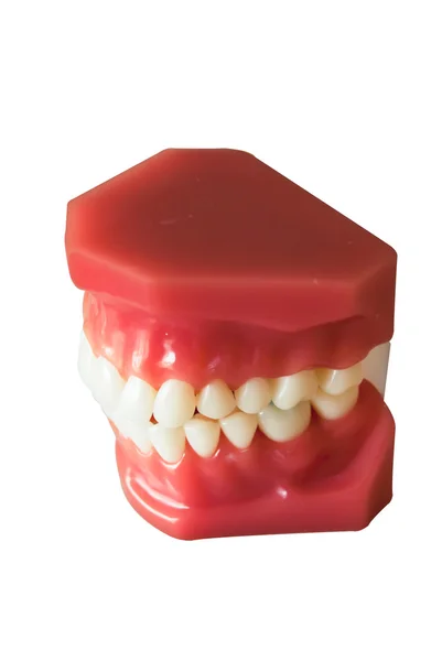 Prothèse dentaire — Photo