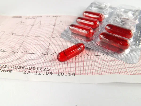 Kardiyogram — Stok fotoğraf