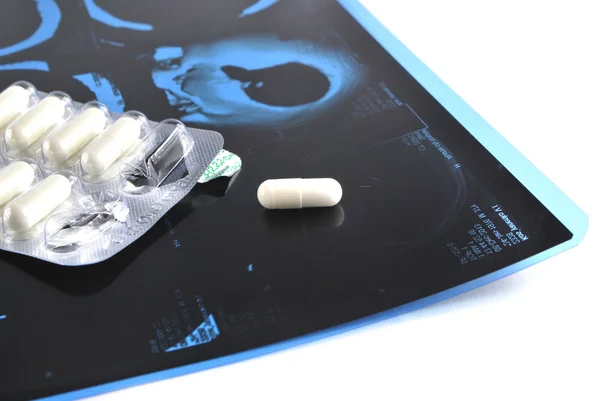 Computed tomography and pills — Stock Photo, Image