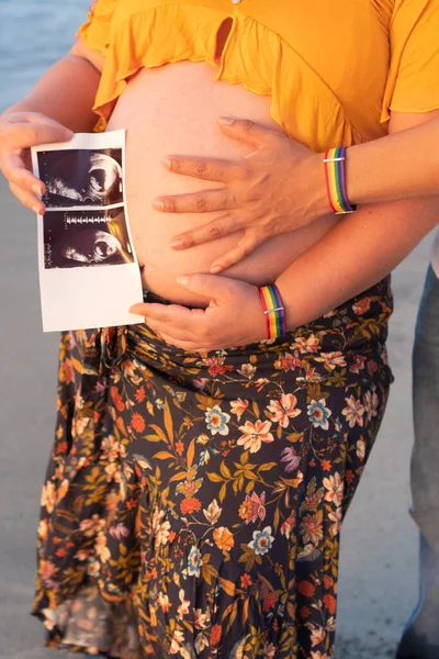 Αγνώριστο Λεσβιακό Ζευγάρι Περιμένει Μωρό — Φωτογραφία Αρχείου