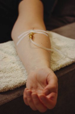Woman's hand with catheter for dropper, butterfly needle used to draw blood from a vein or to deliver intravenous therapy to vein. Thin needle, flexible transparent tubing. Patient in medical clinic.