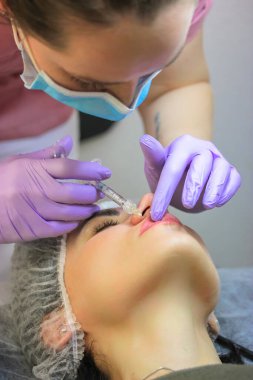 Kozmetik prosedürü. Bir kadın için dudak büyütme işlemi. Bir kozmetolog tıbbi maske takıyor, mor lastik eldivenler dudaklarına hyaluronik asit bazlı dolgu yapıyor. Güzellik enjeksiyon süreci.