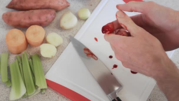 Caucasian Hands Clasp Bleeding Finger Cut While Slicing Vegetables Kitchen — ストック動画