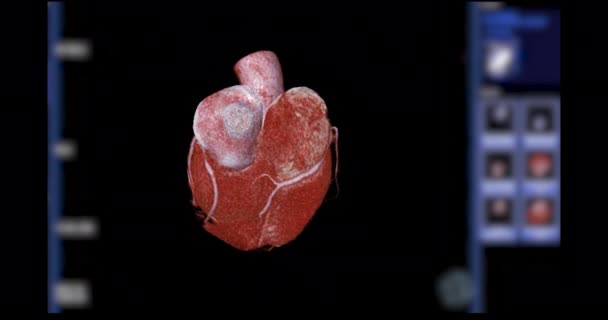 血管冠動脈疾患の診断のための画面上でCta冠動脈3Dレンダリングのオン — ストック動画