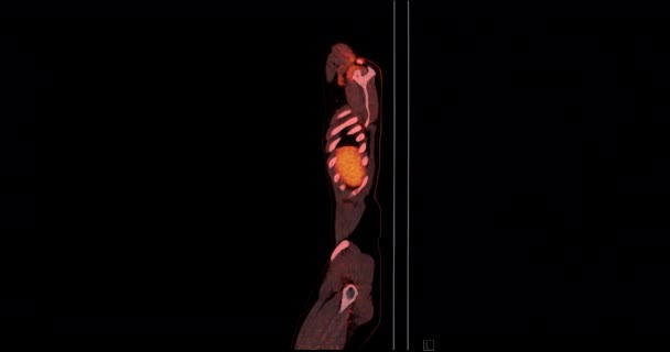 Tüm Insan Vücudunun Pozitron Emisyon Tomografisi Pet Görüntüleme Kırmızı Renk — Stok video