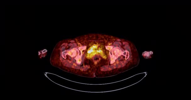 Pet Positron Emission Tomography Whole Human Body Rendering Image Red — Stock Video