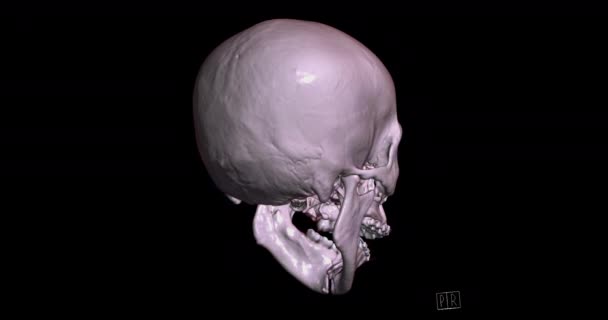Skull Från Datortomografi Skanning Ansiktsben Rendering Visar Mänskliga Skalle Vända — Stockvideo