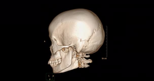 Czaszka Tomografii Komputerowej Skanowanie Kości Twarzy Renderowanie Pokazuje Ludzką Czaszkę — Wideo stockowe
