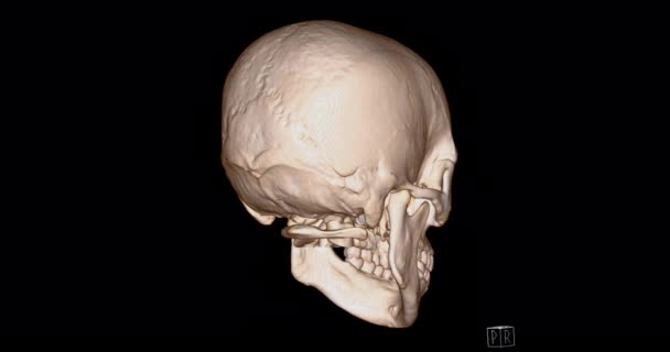 Schädel Aus Scan Von Gesichtsknochen Rendering Zeigt Menschlichen Schädel Auf — Stockvideo