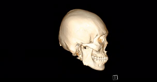 Ctからの頭蓋骨3D顔の骨の3Dレンダリングは 画面上で人間の頭蓋骨の回転を示しています — ストック動画