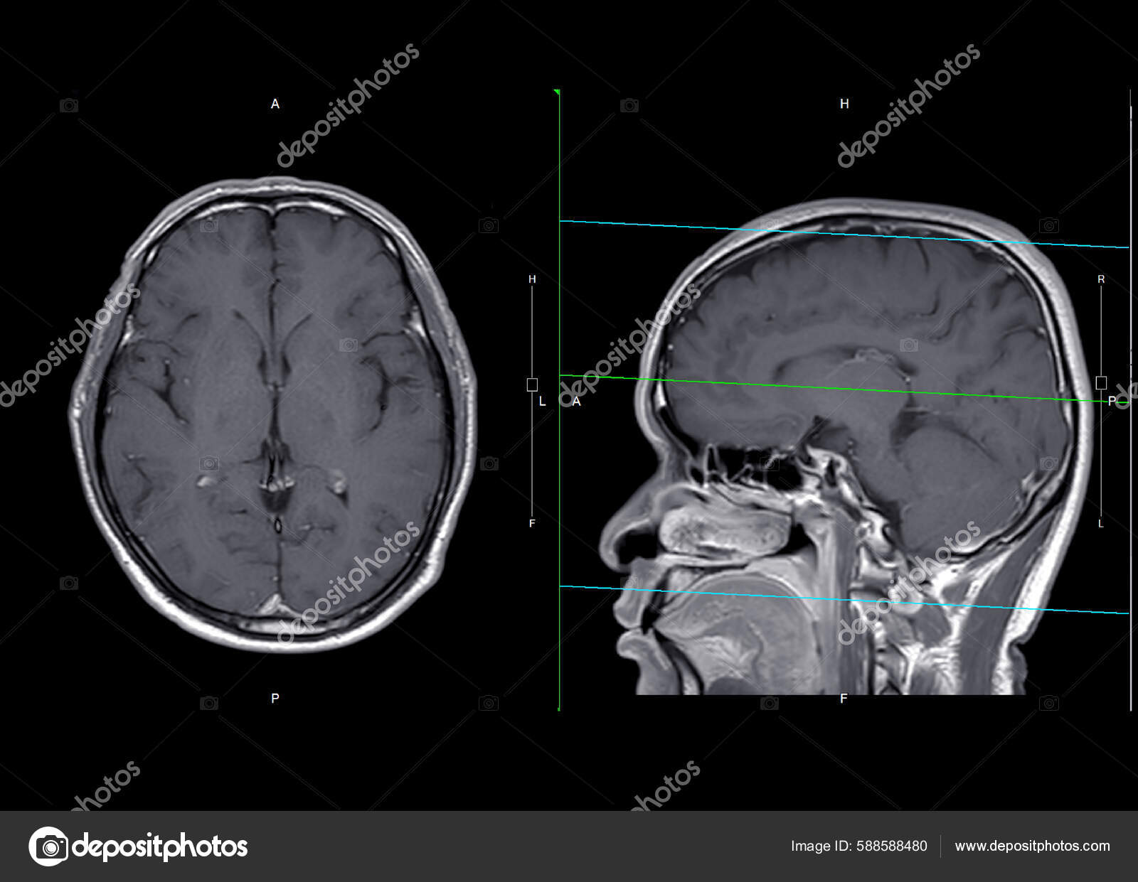 Coronal Plane Through The Head Biology Diagrams