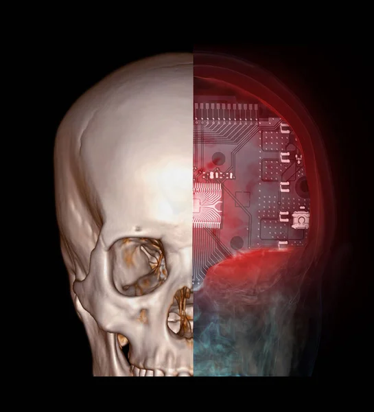 Skull Mri Brain Cpu Medical Imaging Concept — Zdjęcie stockowe
