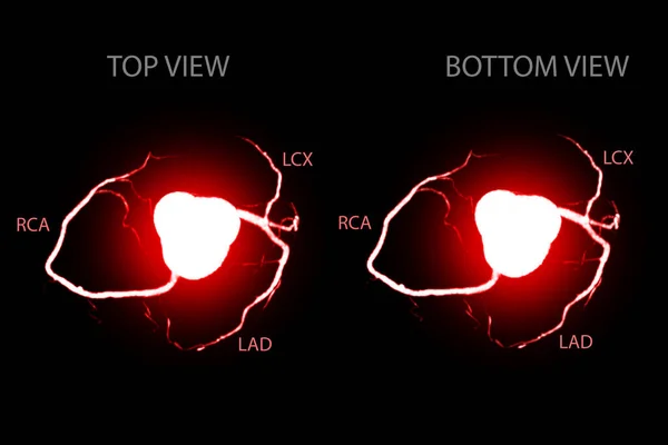 CT Cardiac 3D or CTA coronary artery for prevention coronary artery diseases.