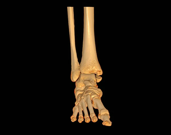 脚部Ct扫描或脚踝关节与足部三维体积成像计算机断层扫描 — 图库照片