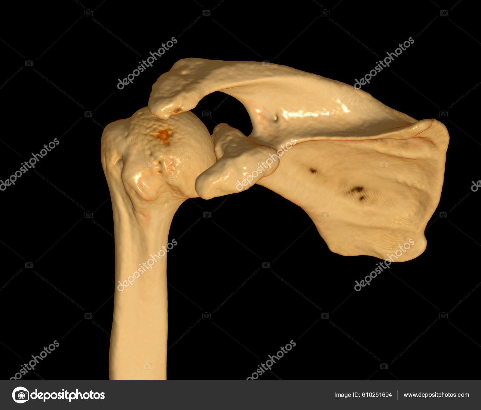 Shoulder Computed Tomography Volume Rendering Examination Shoulder ...