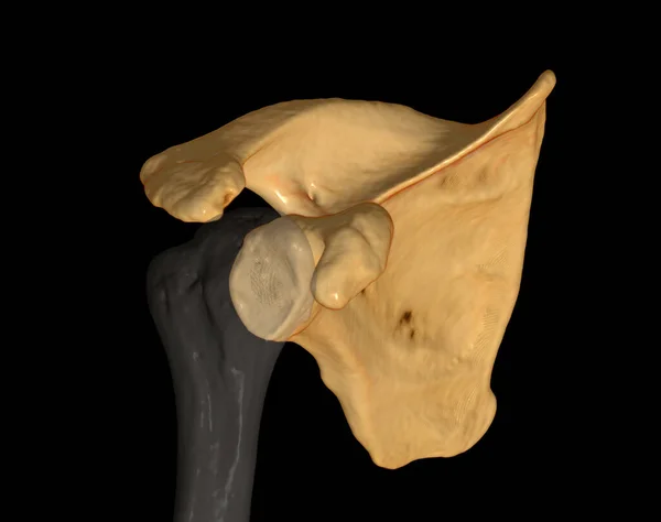 Shoulder Computed Tomography Volume Rendering Examination Shoulder Rendering Case Fracture — Fotografia de Stock