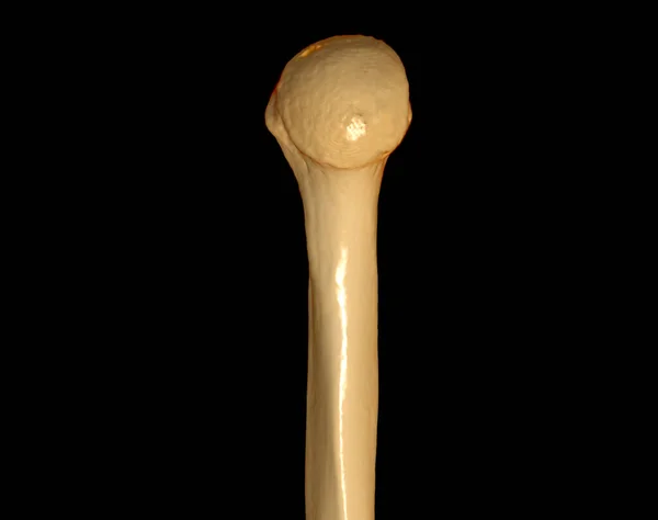 Scan Head Humerus Computed Tomography Volume Rendering Examination Humerus Bone — Stock Photo, Image