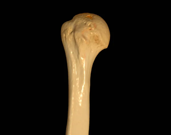 Scan Head Humerus Computed Tomography Volume Rendering Examination Humerus Bone — Stock Photo, Image