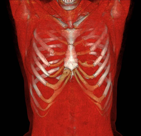 Ct胸部3Dレンダリングリブケージスケルトン人間の骨システムを示しています 解剖学的に正しい胸郭 — ストック写真