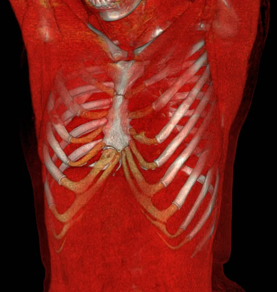 CT Chest 3d rendering showing Rib cage Skeleton Human bones system . Realistic Chest anatomically correct ribcage .