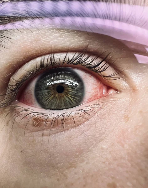 Macro shot of a human red eye. Concept of infection in the eyeballs.