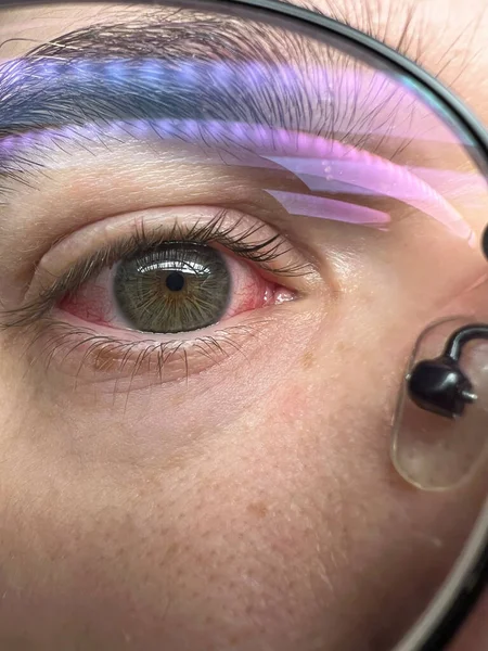 Makro Záběr Lidského Červeného Oka Koncept Infekce Očních Bulvách — Stock fotografie