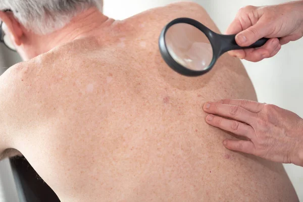 Dermatolog Vyšetření Kůže Pacienta Zpět — Stock fotografie