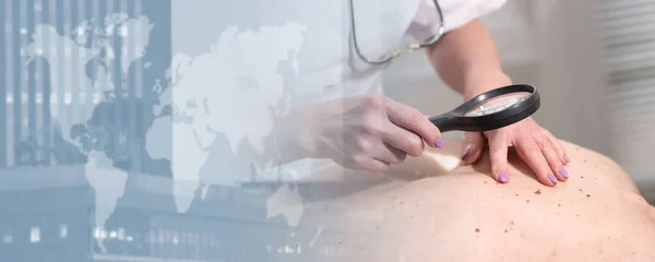 皮膚科医は患者の背中の皮膚を調べる パノラマバナー — ストック写真