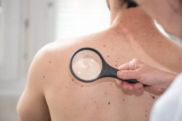 Dermatolog Vyšetření Kůže Pacienta Zpět — Stock fotografie