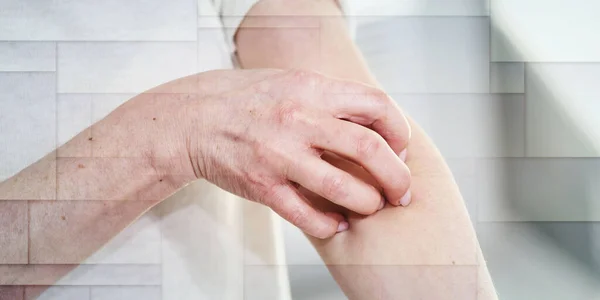 彼女の腕をかゆみ 引っ掻いている女性 アレルギー症状幾何学的パターン — ストック写真
