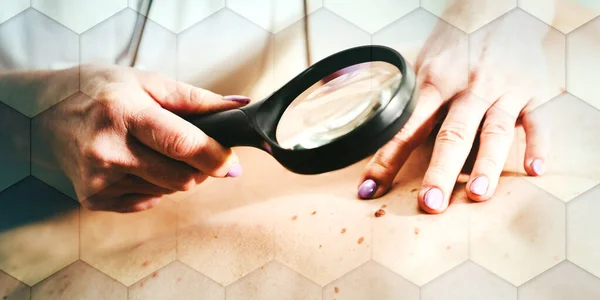 Dermatologist Examining Skin Back Patient Geometric Pattern — Stock Photo, Image