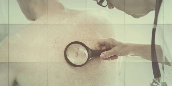 Dermatologist Examining Skin Back Patient Geometric Pattern — Foto de Stock