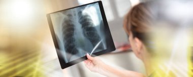Tıbbi ofiste röntgen incelemesi yapan kadın doktor, çoklu maruz kalma.