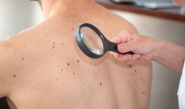 Dermatolog hastanın cildini inceliyor.