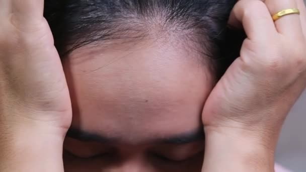 Asian Woman Touching Forehead Suffering Headache Migraines Depression Troubled Woman — Vídeo de Stock